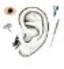 Centro de Acupuntura Profesional 